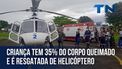 Criança tem 35% do corpo queimado e é resgatada de helicóptero