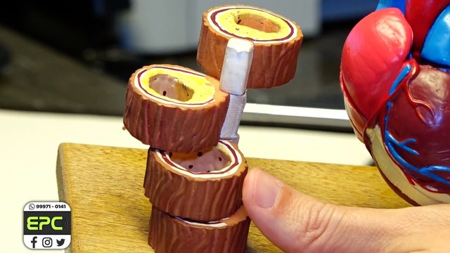 Setembro Amarelo é o mês de conscientização em relação às doenças cardiovasculares