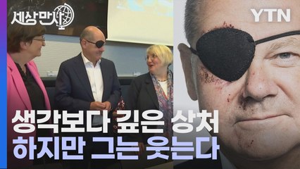 [세상만사] 조깅하다 얼굴 심하게 긇힌 독일 총리의 광폭 행보 / YTN