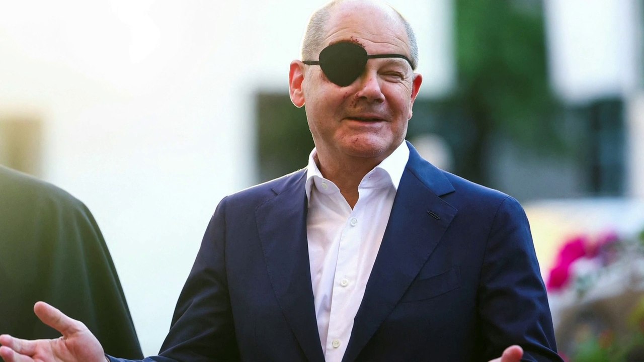 المستشار الألماني يفاجئ متابعيه على "إكس" بصورة تظهر رقعة سوداء على عينه وكدمات على وجهه #العربية