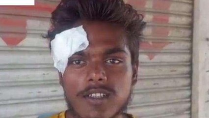 लखनऊ: बेखौफ दबंगों ने युवक को बेरहमी से पीटा,पीड़ित ने कार्रवाई की मांग