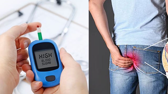 डायबिटीज में बवासीर होने पर क्या करना चाहिए | Diabetes Me Piles Hone Per Kya Karna Chahiye