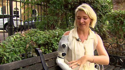 London mother shows off groundbreaking bionic arm
