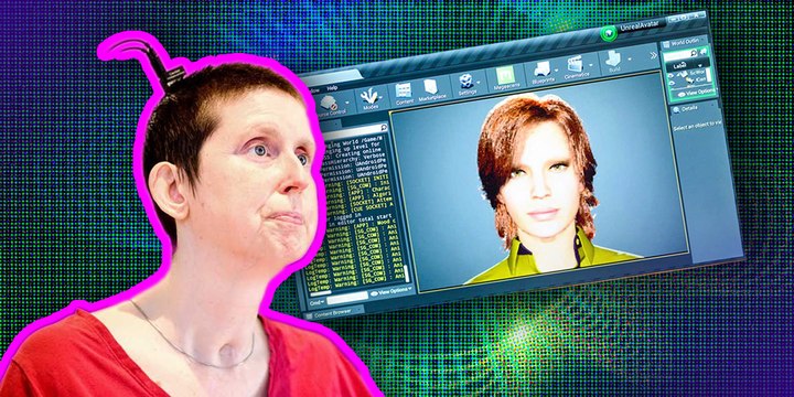 Una mujer con parálisis volvió a hablar después de 18 años gracias a un implante cerebral