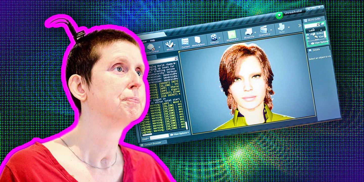 Una mujer con parálisis volvió a hablar después de 18 años gracias a un implante cerebral