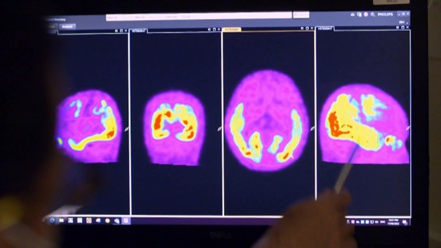 Senate concussion inquiry makes 13 recommendations to prevent head trauma