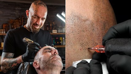 “I Forked Out £2K to Have Thousands of Tiny Dots Tattooed as Hair on My Head - My Wife Loves My New Look”