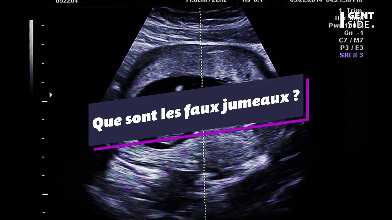 Vrai ou faux jumeaux quelle est la différence ? Vidéo Dailymotion