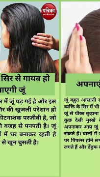 दो दिन में सिर से गायब हो जाएगी जूं, अपनाएं ये देसी उपाय