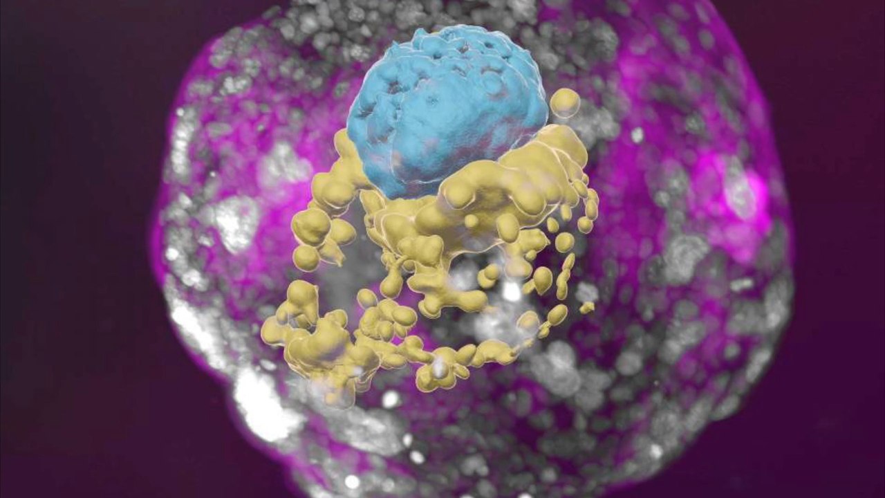 Israel: menschlicher embryo in labor gezüchtet