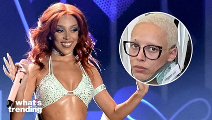 Doja Cat Clarifies She Is 'Fine' After Posting Photo in Neck Brace