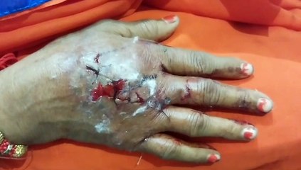 खेत में गई महिला के मुंह पर सियार ने किया हमला