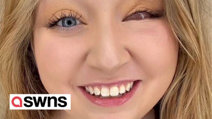 "I lost my eye after wearing $300 sunglasses in a car accident - the airbag smashed them into my face"