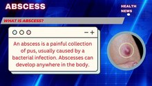 ✅Skin Abscess ✅ Causes, Symptoms, Treatment, Prevention #abscess #skinabscess #internamabscess