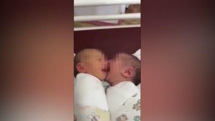 Il neonato ha fame e succhia la guancia al fratellino
