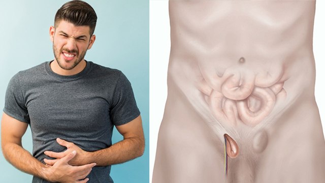 Male Hernia Symptoms | Male Hernia Reason In Hindi | पुरुषों में हर्निया के लक्षण | Boldsky