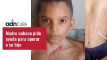 Madre cubana pide ayuda para operar a su hijo