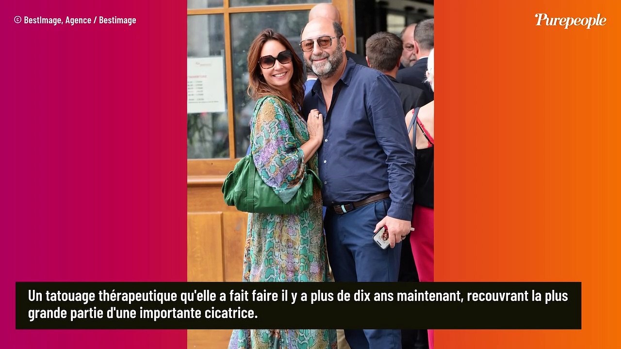"Mon bras ne grandira plus" : Julia Vignali brûlée au troisième degré, confidences sur son tatouage thérapeutique