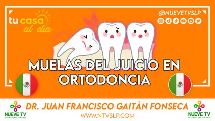 Muelas del Juicio en Ortodoncia