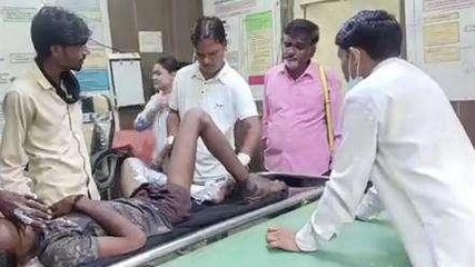 अशोकनगर: आग में झुलसा युवक, हालत गम्भीर, जारी उपचार
