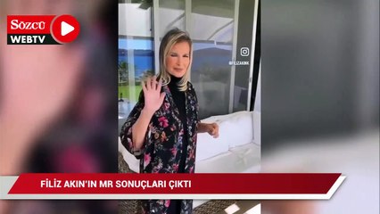 Filiz Akın'ın MR sonucu çıktı