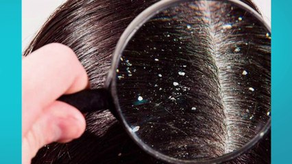 bd-caspa-incontrolable-130923