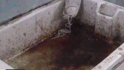 आगरा: एसएन मेडिकल कॉलेज के दावों की खुली पोल