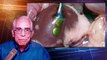 Implant Detects Transplant Rejection Earlier