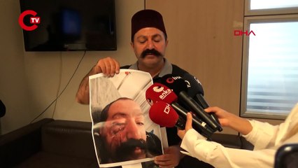 Sosyal medya fenomeni, ev sahibi tarafından darp edildiğini iddia etti