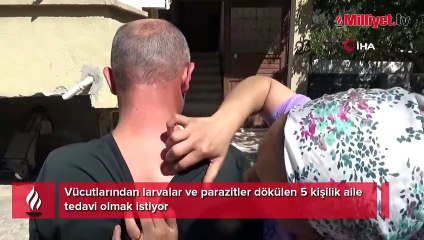 5 kişilik ailenin vücutlarından kurtçuklar fışkırıyor! Doktorlar bile inanmadı