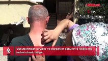 5 kişilik ailenin vücutlarından kurtçuklar fışkırıyor! Doktorlar bile inanmadı