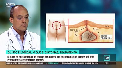 Consultório - Prof. Doutor André Goulart, Médico de Cirurgia Geral no Trofa Saúde BRAGA Sul, Maia e Trofa (parte 1)