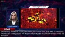 Person dies of rare brain-eating amoeba traced to splash pad at Arkansas