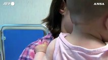 Screening precoci sui bambini per prevenire diabete e celiachia