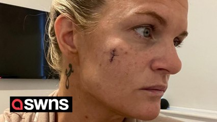 Woman who had skin cancer TWICE due to tanning beds creates her own fake tan product