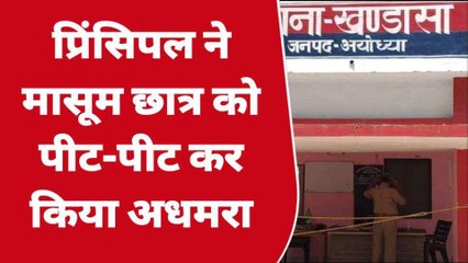 अयोध्या: होमवर्क पूरा न मासूम को पड़ा महंगा, नाराज टीचर ने कर दिया ये हाल