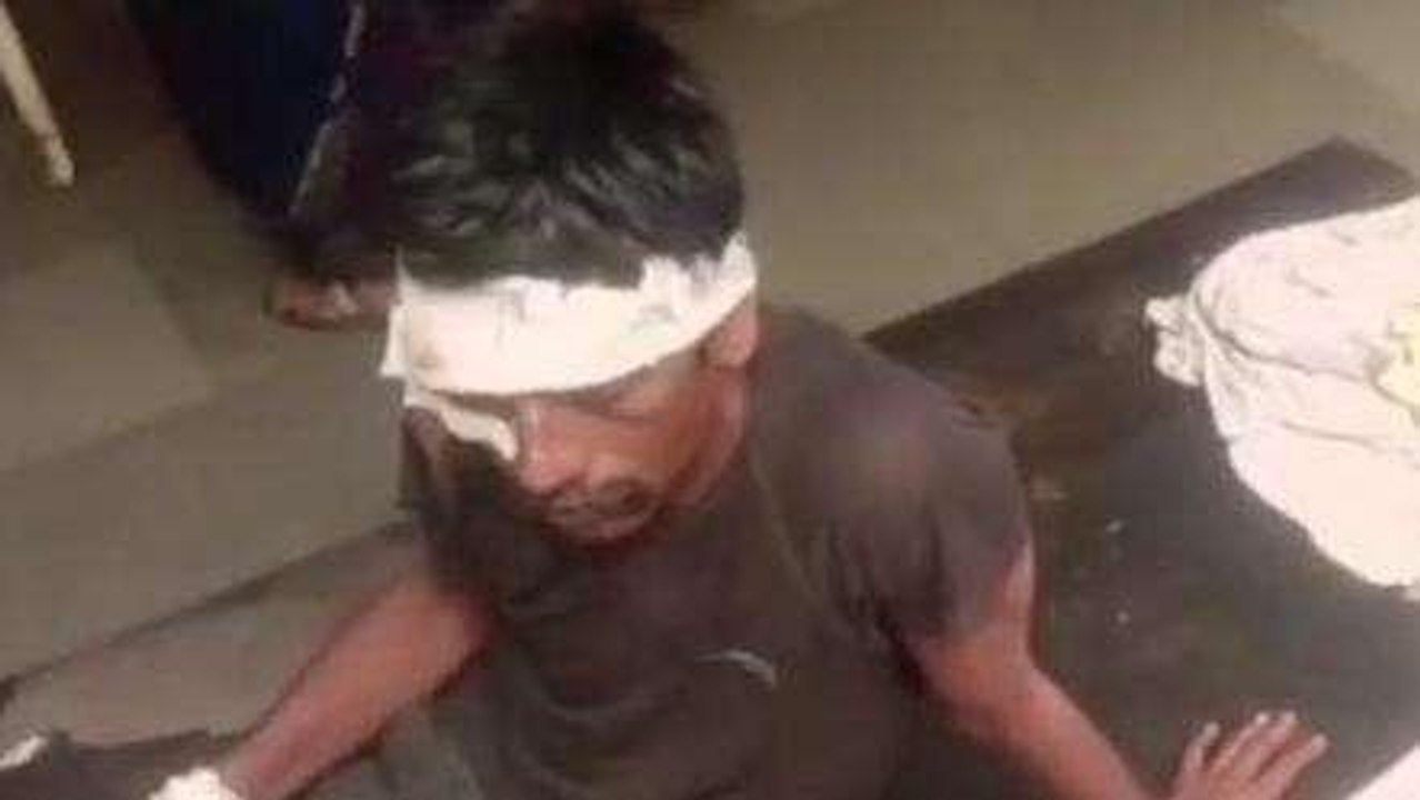 अशोकनगर: सड़क दुर्घटना का शिकार हुए दो लोग, जारी उपचार