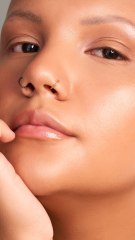 CAM - Quelles sont les causes de l'alopécie ?