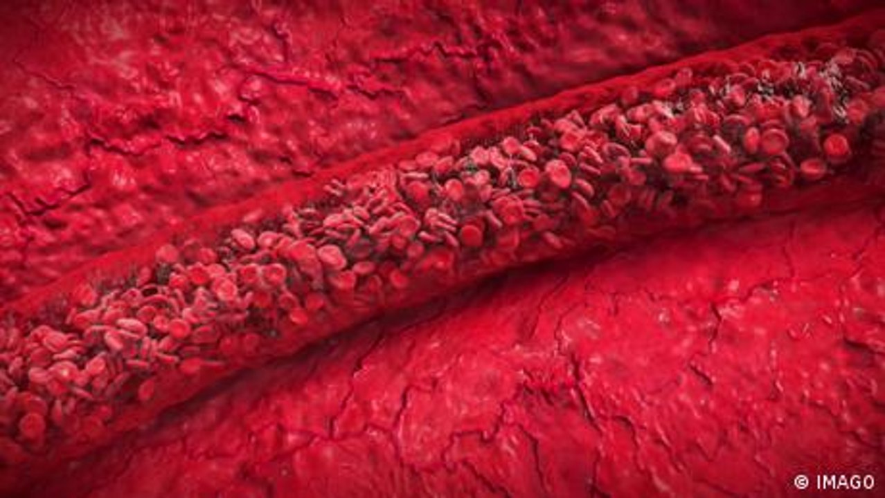 Woraus besteht unser Blut? Und wo wird es gebildet?