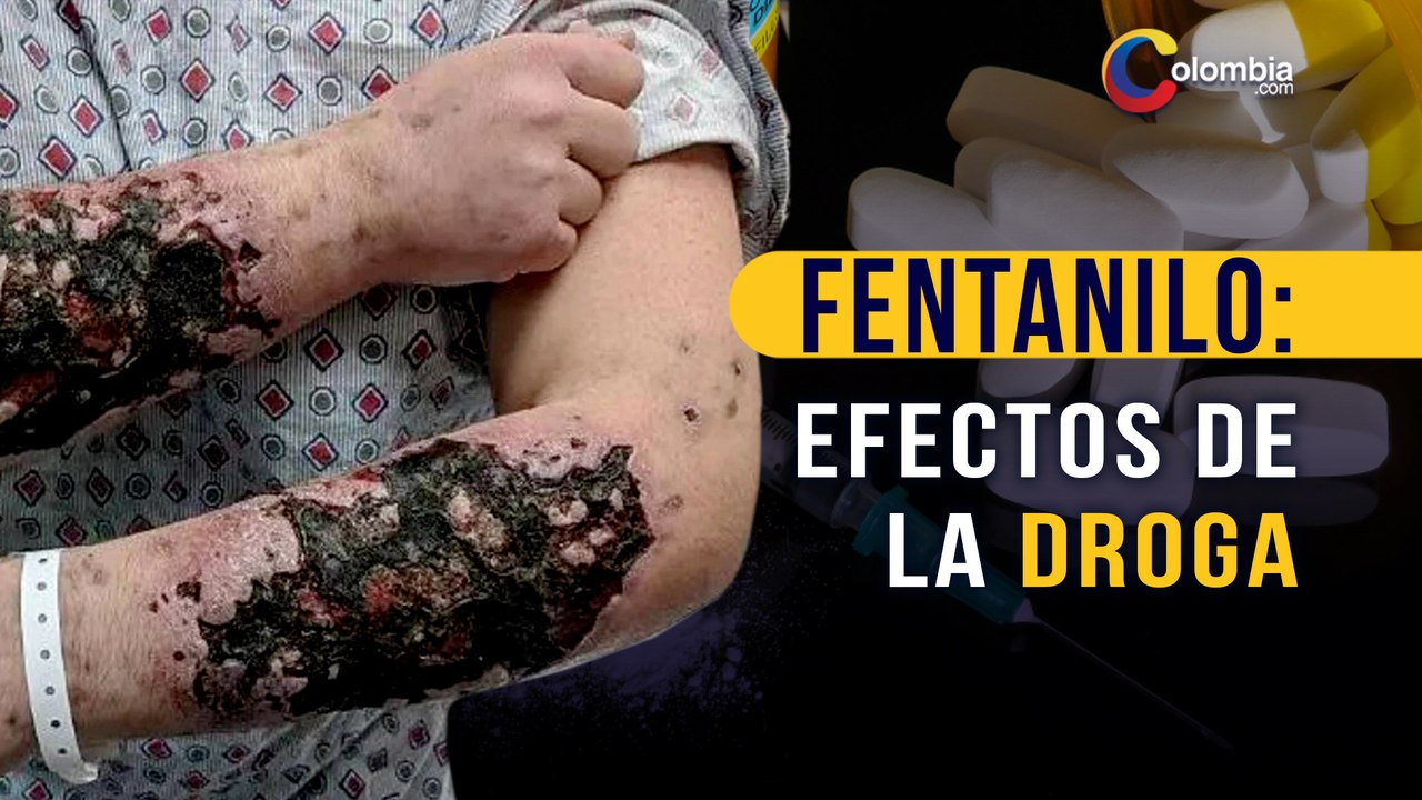 Fentanilo: ¿de qué trata la “droga zombie” que ya enciende las alarmas en Latinoamérica?