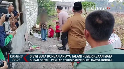 Begini Kata Dokter RS PHC Surabaya Usai Periksa Siswi SD yang Buta Akibat Dianiaya Kakak Kelas