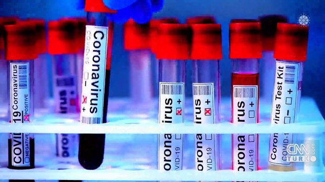 Okullarda salgın hastalık riskine dikkat!