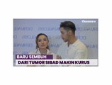 Berat Badan Siti Badriah Turun Drastis, Netizen Khawatir