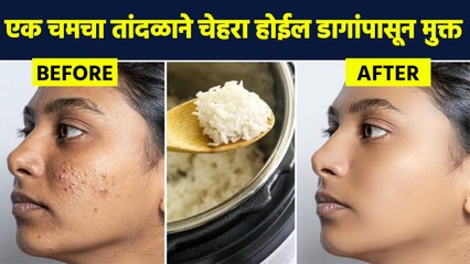 Download Video: एक चमचा तांदळाने होतील चेहऱ्यावरील पिंपल्स दूर? | Smooth And Glowing Skin Tips | Rice Face Pack AI2