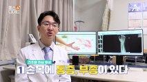 ※손목이 아프다면 주목※ 손목터널 증후군과 건초염의 차이점은?