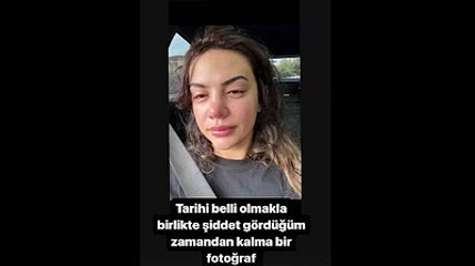 Ece Ronay sosyal medyadan yardım istedi: Defalarca ölüm tehdidi aldım