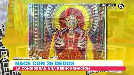¿UNA DIOSA? Nace bebé con 26 dedos