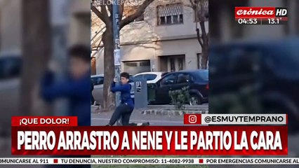 ¡Perro enloquecido arrastró a nene y le provoca tremendo gope!