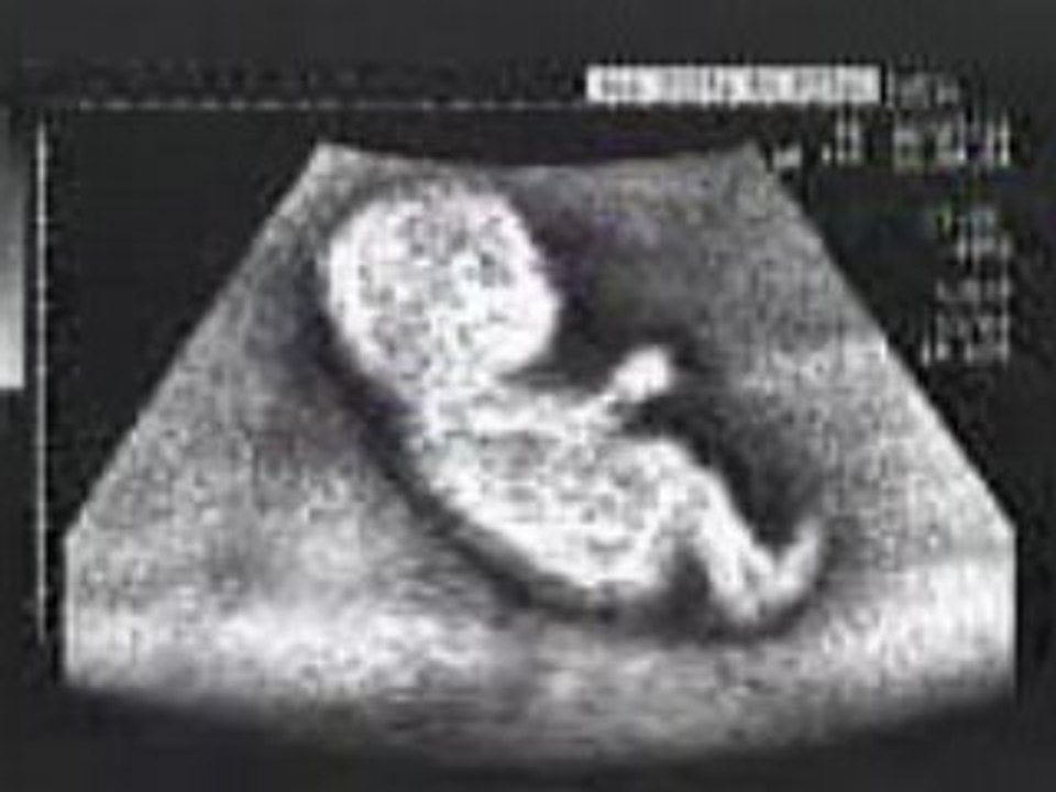 Bebe