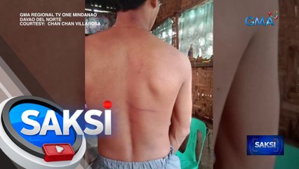 19-anyos na lalaki, pinagbubugbog umano ng isang pulis | Saksi